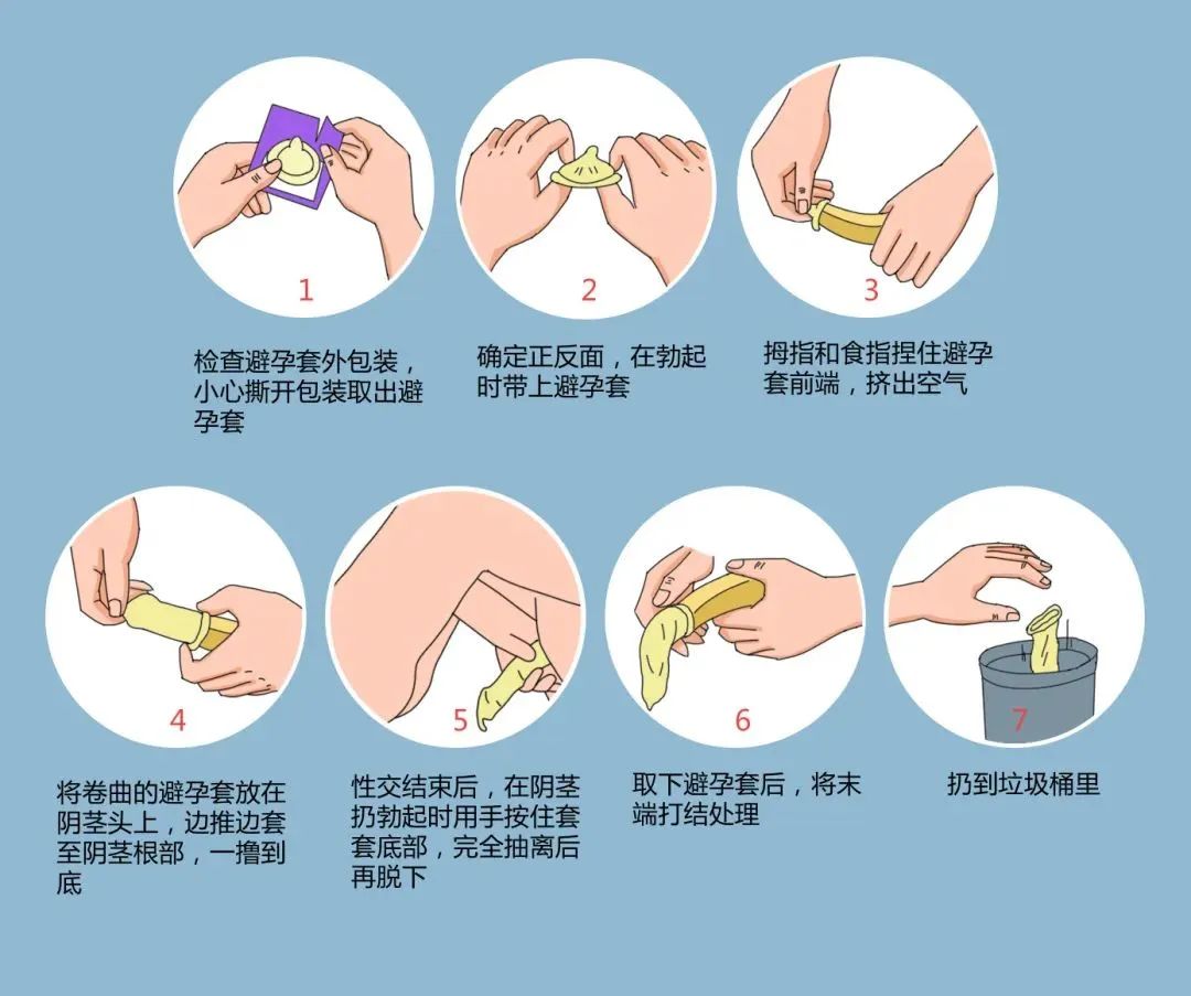年輕人成艾滋病重災區(qū)，正確戴套很有必要.jpg